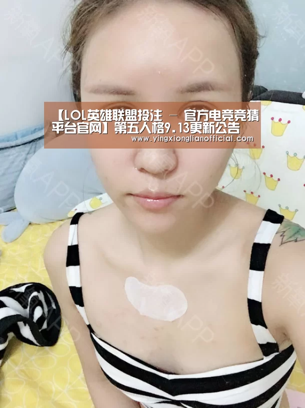 电竞直播